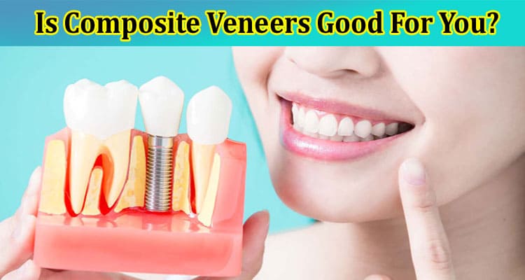 Know Details Is Composite Veneers Good For You